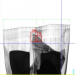 センターシール付近の噛み込み